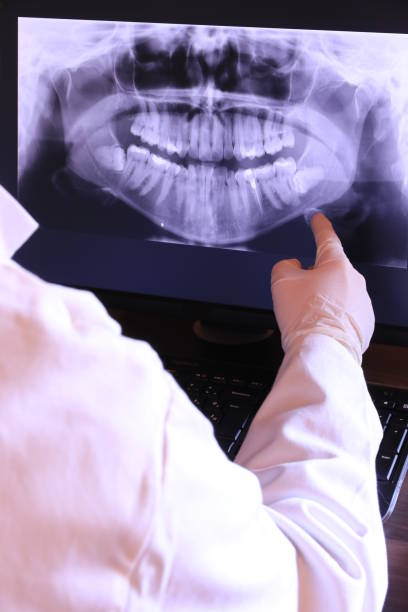 Best Broken or Cracked Tooth Emergency Dentist in Oviedo, FL